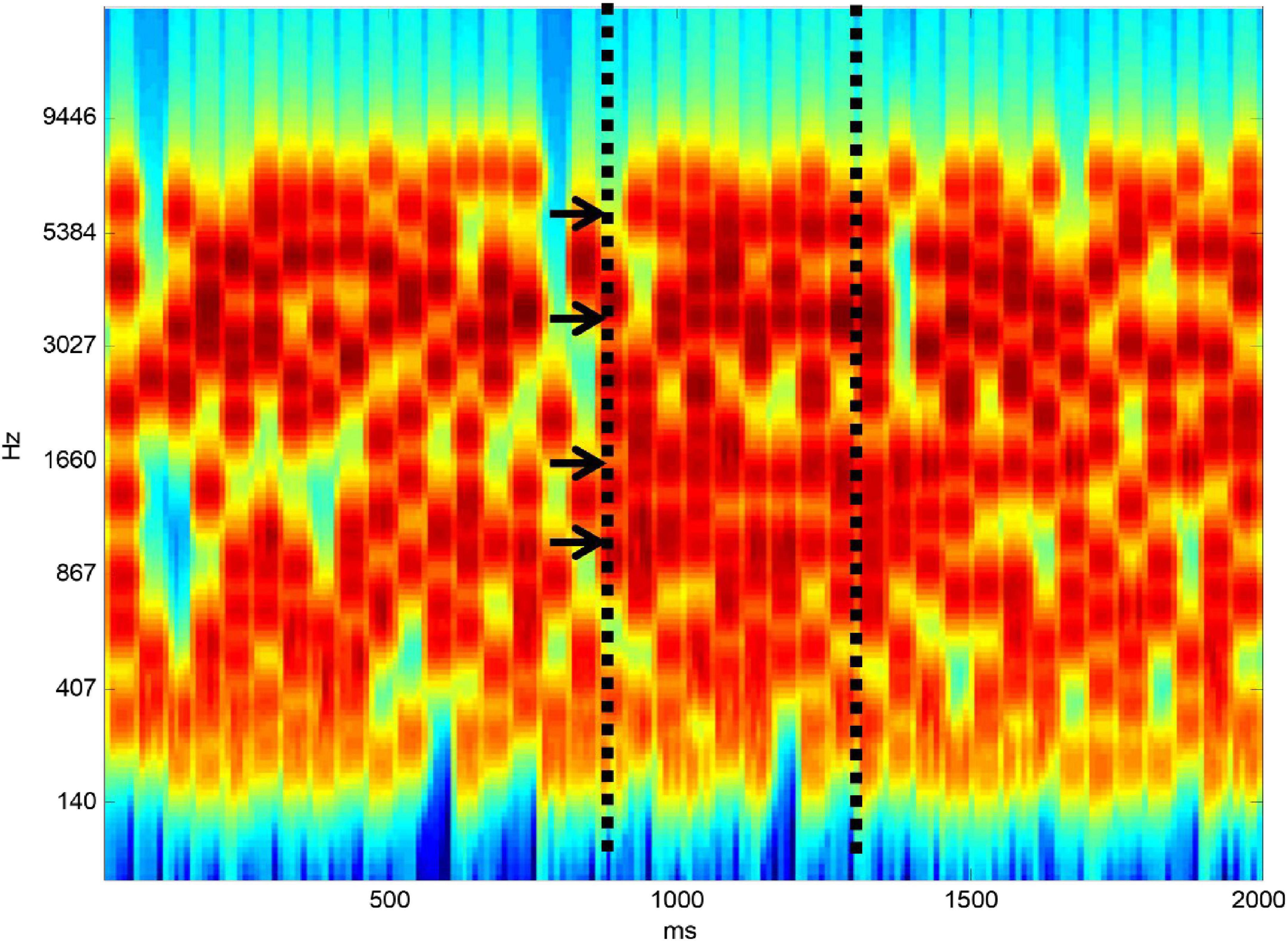 Predicting speech-in-noise ability in normal and impaired hearing based on auditory cognitive measures